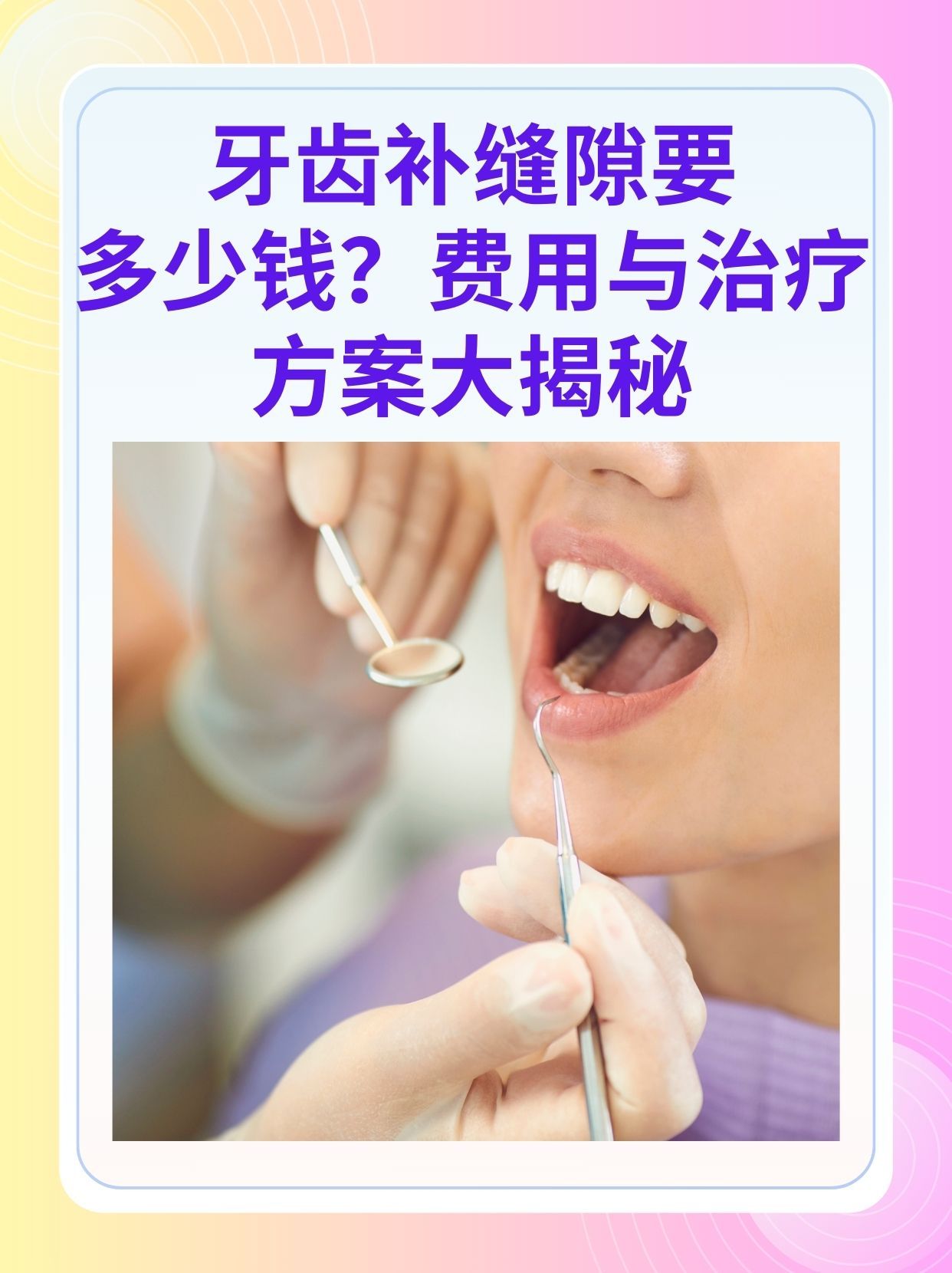 黑河补牙医保可以报销吗(补牙医保可以报销吗 哪些可以报销呢)